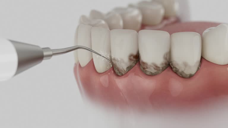 Trusted Root Canal Treatment service in Island Heights, NJ - Dentist Open Now